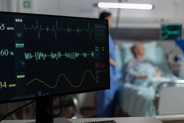 ECG