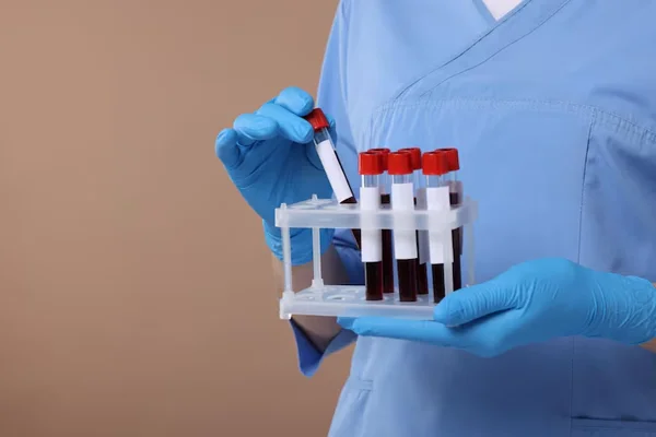 Blood Tests